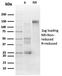 MAPK1/ERK2 (Transcription Factor) Antibody in SDS-PAGE (SDS-PAGE)
