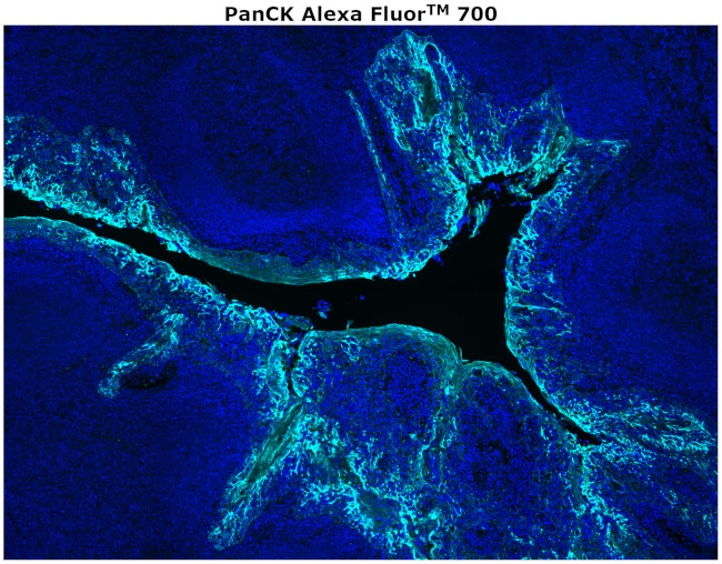 Pan Cytokeratin Antibody in Immunohistochemistry (Paraffin) (IHC (P))