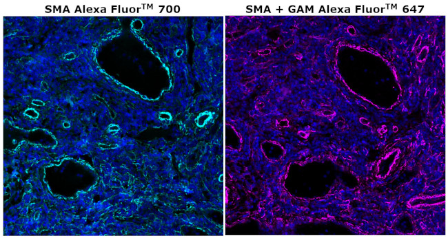 Alpha-Smooth Muscle Actin Antibody in Immunohistochemistry (Paraffin) (IHC (P))