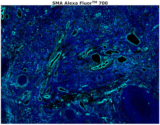 Alpha-Smooth Muscle Actin Antibody in Immunohistochemistry (Paraffin) (IHC (P))