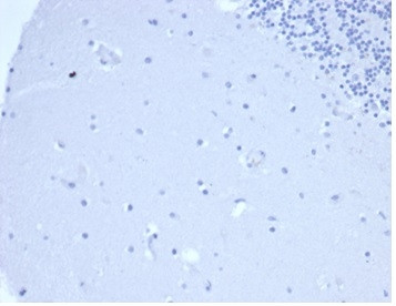 Prolactin (Pituitary Tumor Marker) Antibody in Immunohistochemistry (Paraffin) (IHC (P))