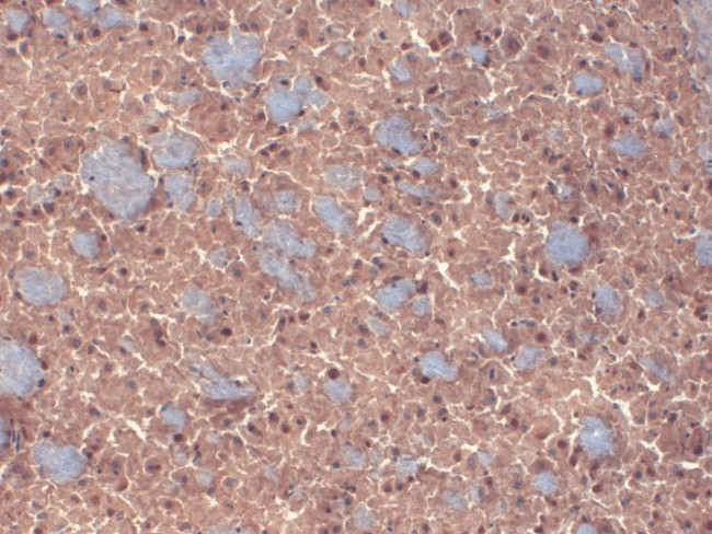 Beta 3 GABA-A Receptor Antibody in Immunohistochemistry (IHC)