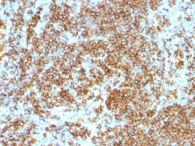 CD45RB (B-Cell Marker) Antibody in Immunohistochemistry (Paraffin) (IHC (P))