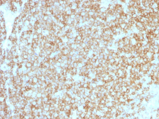 CD45/LCA Antibody in Immunohistochemistry (Paraffin) (IHC (P))