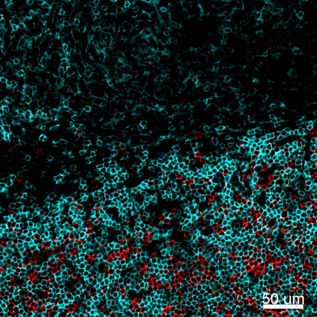 CD4 Antibody in Immunohistochemistry (IHC)