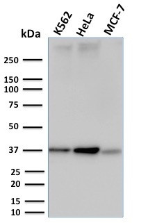 RAD51 (Prognostic and Response to Chemotherapy Marker) Antibody in Western Blot (WB)