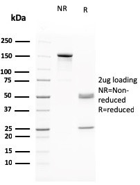 RAD51 (Prognostic and Response to Chemotherapy Marker) Antibody in SDS-PAGE (SDS-PAGE)