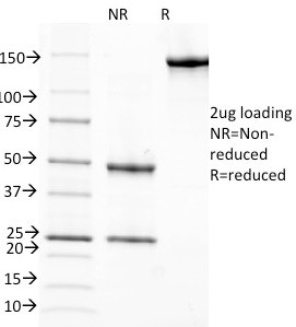 Retinol Binding Protein-1 (RBP1) Antibody in SDS-PAGE (SDS-PAGE)