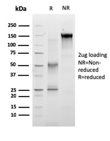 RET Proto-oncogene Antibody in SDS-PAGE (SDS-PAGE)