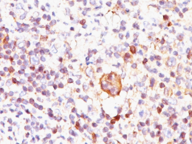 Bcl-X (Apoptosis Marker) Antibody in Immunohistochemistry (Paraffin) (IHC (P))