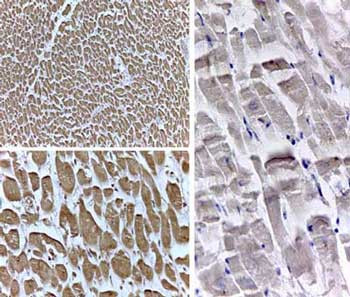 PPAR Delta Antibody in Immunohistochemistry (IHC)