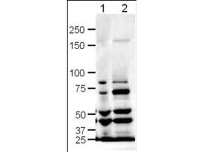 Slit1 Antibody in Western Blot (WB)