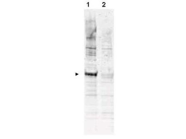 Phospho-APC6 (Thr580) Antibody in Western Blot (WB)