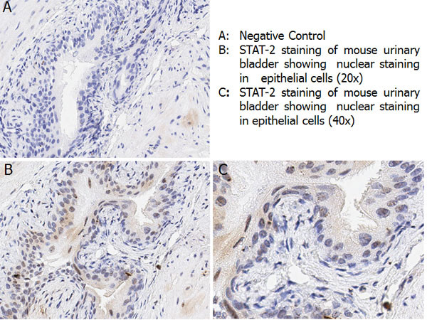 Phospho-STAT2 (Tyr690) Antibody in Immunohistochemistry (Paraffin) (IHC (P))