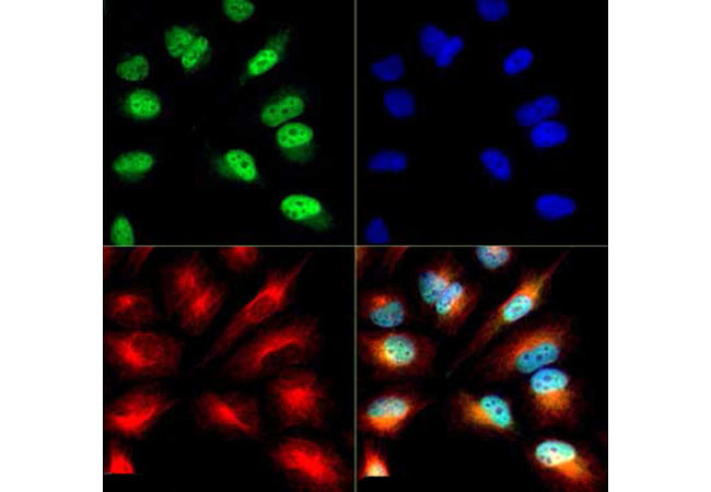 H3K9acS10ph Antibody in Immunocytochemistry (ICC/IF)