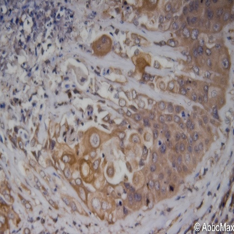 Phospho-IRAK4 (Thr345) Antibody in Immunohistochemistry (Paraffin) (IHC (P))