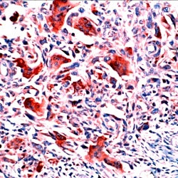 Osteopontin (SPP1) Antibody in Immunohistochemistry (Paraffin) (IHC (P))