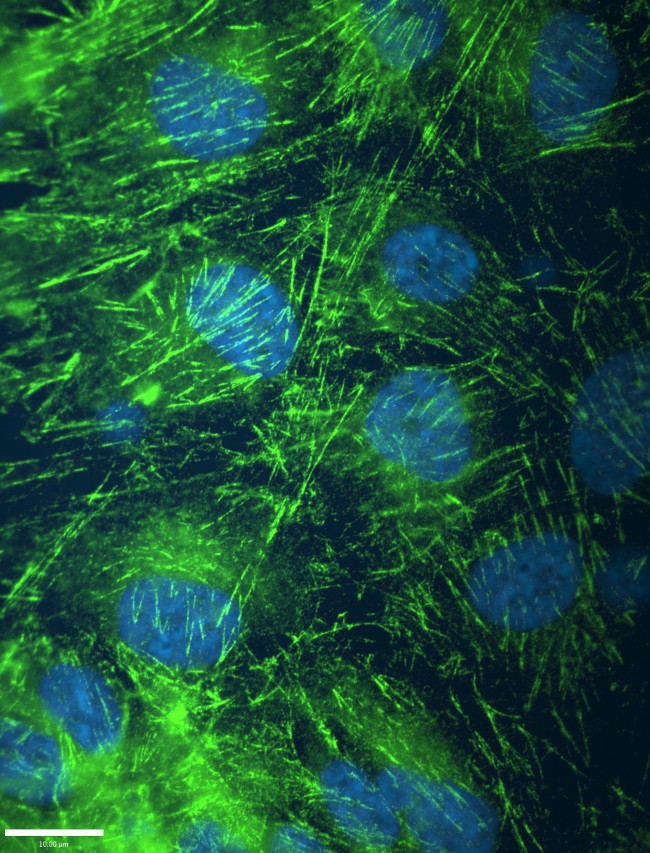 SEPT2 Antibody in Immunocytochemistry (ICC/IF)