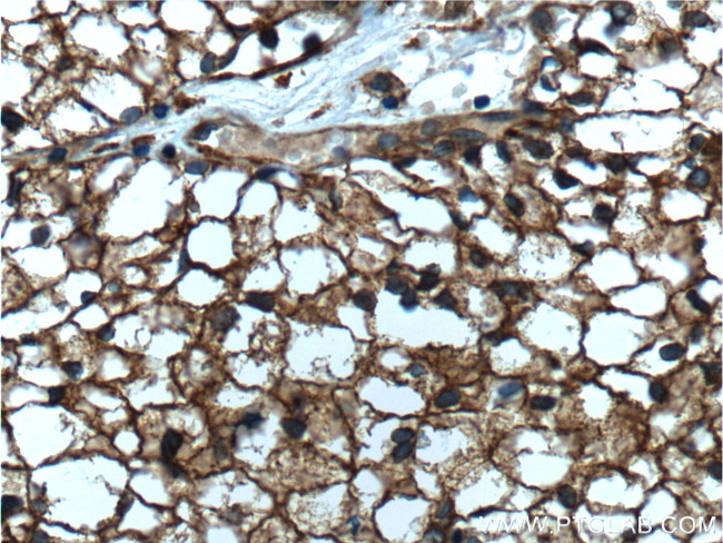 SEPT2 Antibody in Immunohistochemistry (Paraffin) (IHC (P))