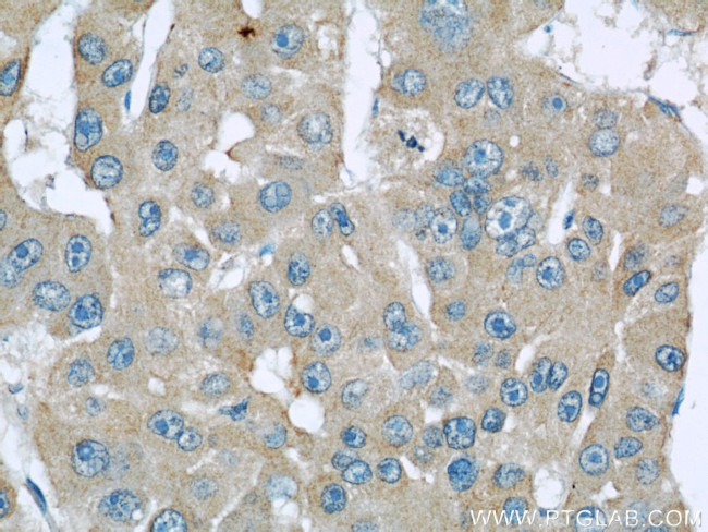 SEPT2 Antibody in Immunohistochemistry (Paraffin) (IHC (P))