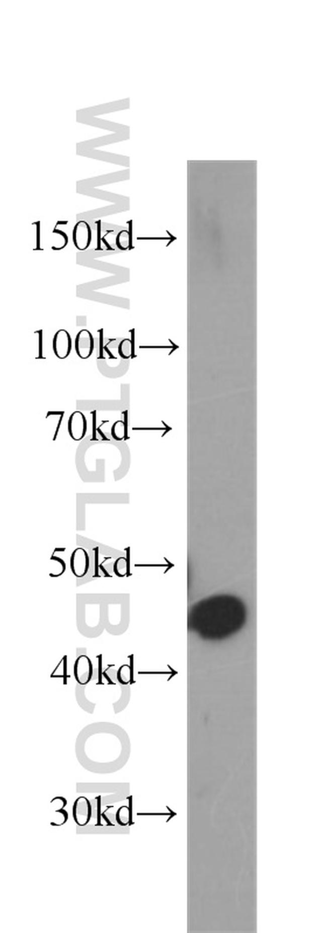 SEPT2 Antibody in Western Blot (WB)