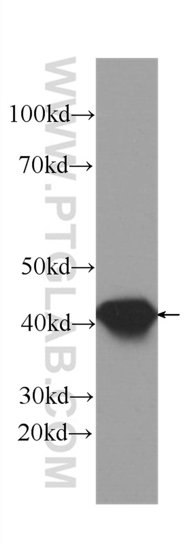 SEPT2 Antibody in Western Blot (WB)