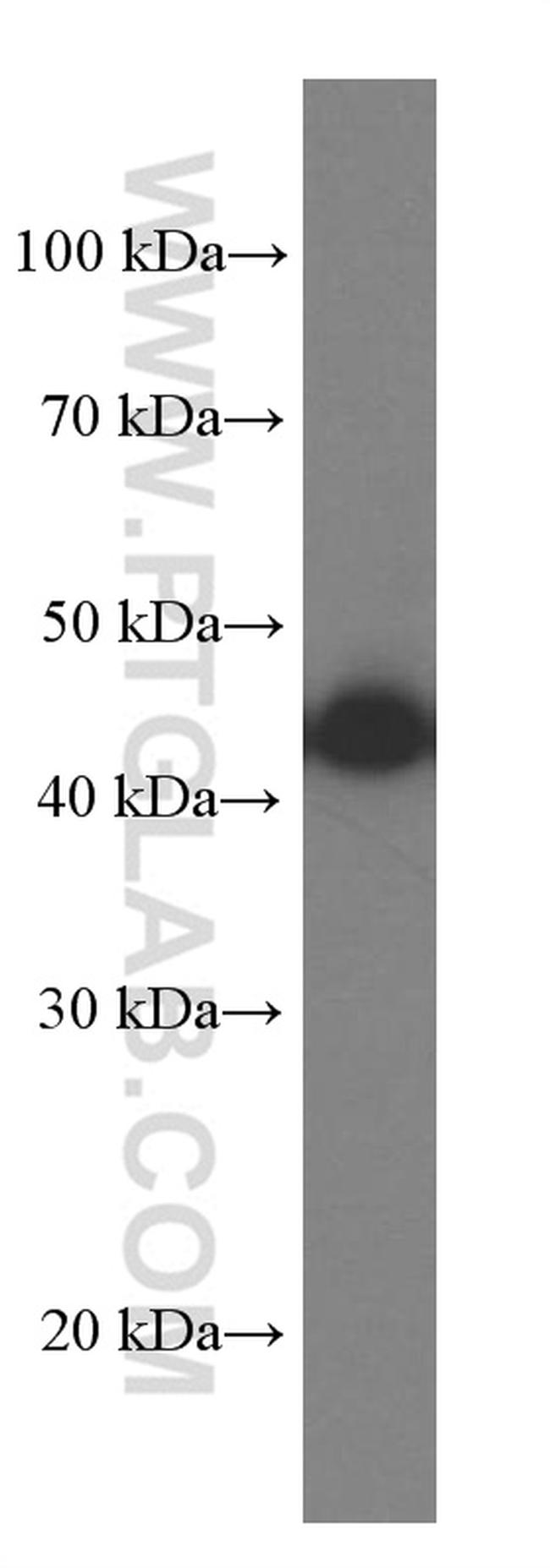 SEPT2 Antibody in Western Blot (WB)