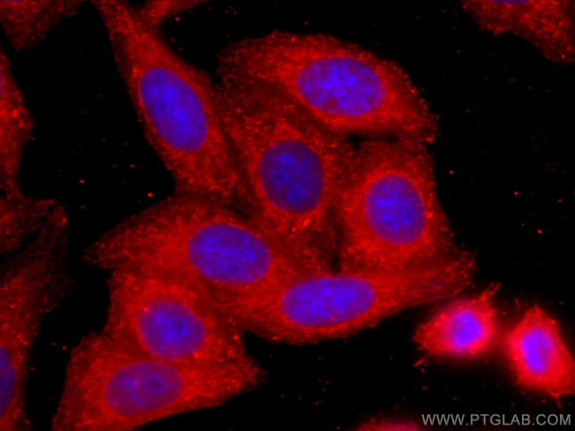 COTL1 Antibody in Immunocytochemistry (ICC/IF)