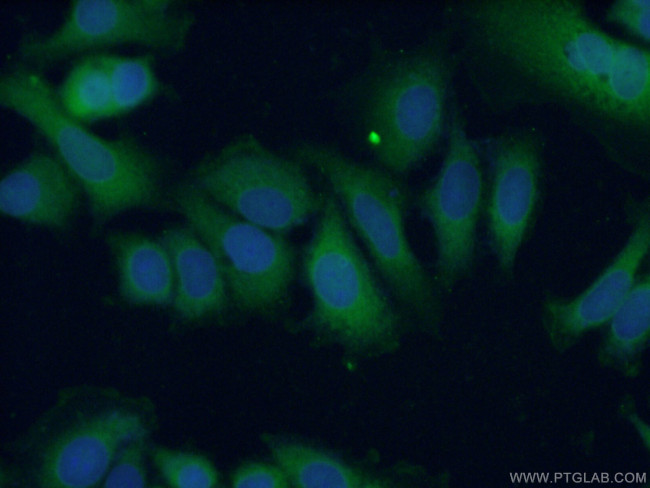 BAX Antibody in Immunocytochemistry (ICC/IF)