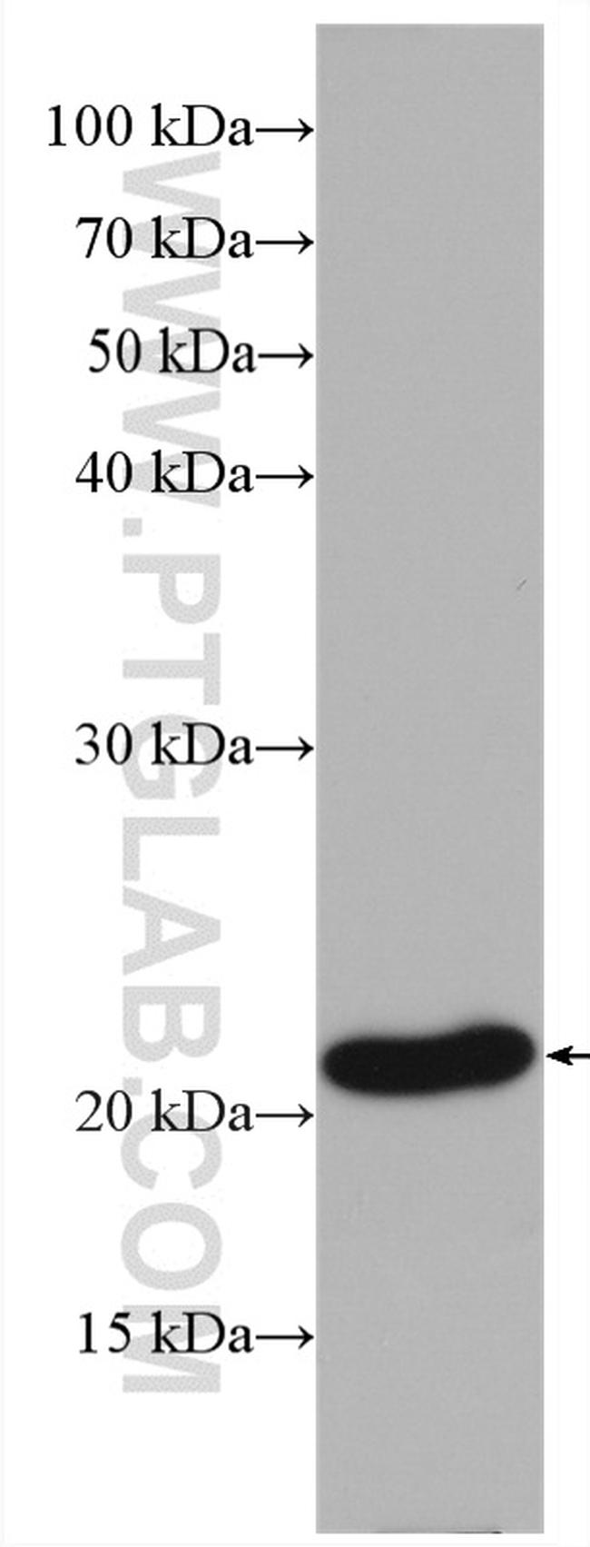 BAX Antibody in Western Blot (WB)