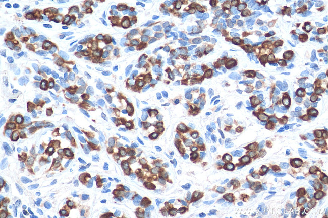 TNF alpha Antibody in Immunohistochemistry (Paraffin) (IHC (P))