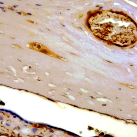 hCG a-subunit Antibody in Immunohistochemistry (Paraffin) (IHC (P))