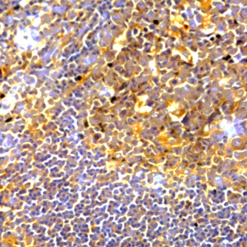 PD-L1 Antibody in Immunohistochemistry (Paraffin) (IHC (P))