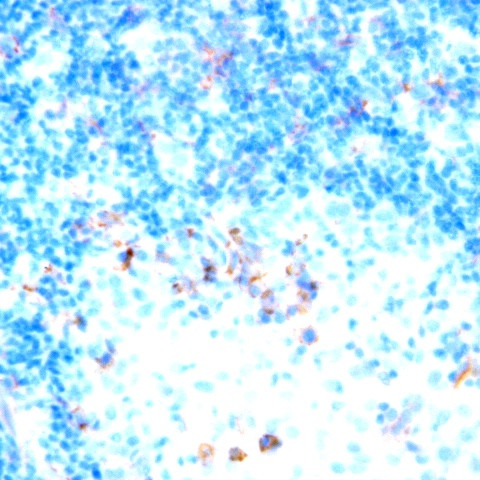 CD47 Antibody in Immunohistochemistry (Paraffin) (IHC (P))