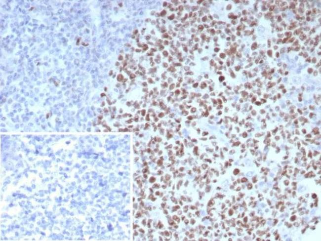 Bcl-6 (Follicular Lymphoma Marker) Antibody in Immunohistochemistry (Paraffin) (IHC (P))