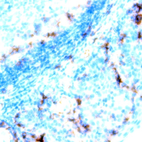 CD95L Antibody in Immunohistochemistry (Paraffin) (IHC (P))