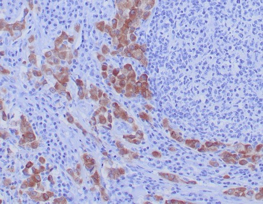 ROS1 Antibody in Immunohistochemistry (Paraffin) (IHC (P))