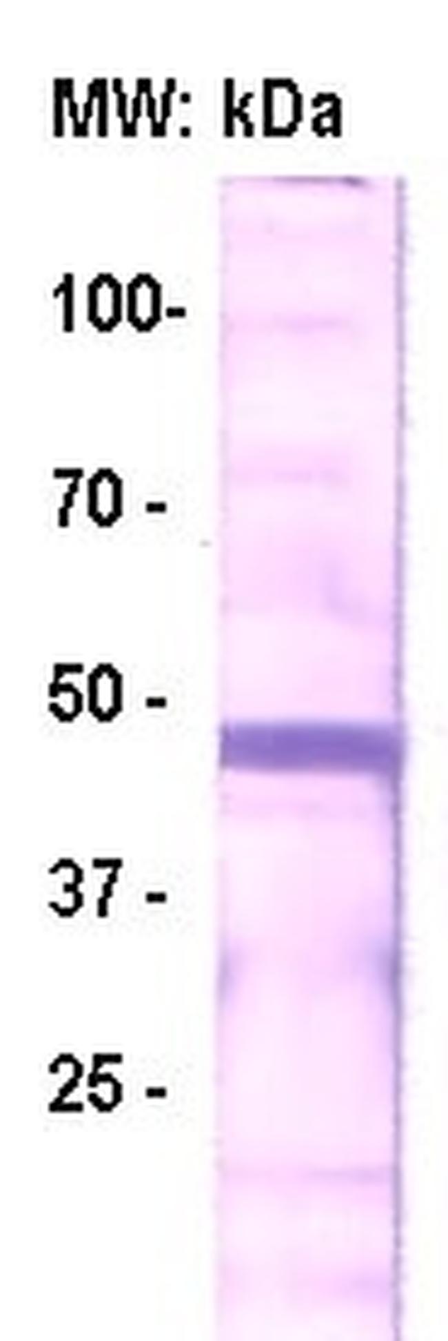 HPV (Human Papillomavirus), E7 protein Antibody in Western Blot (WB)