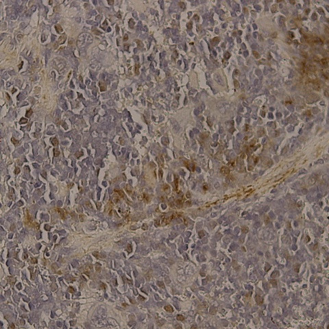 ADM2 Antibody in Immunohistochemistry (Paraffin) (IHC (P))