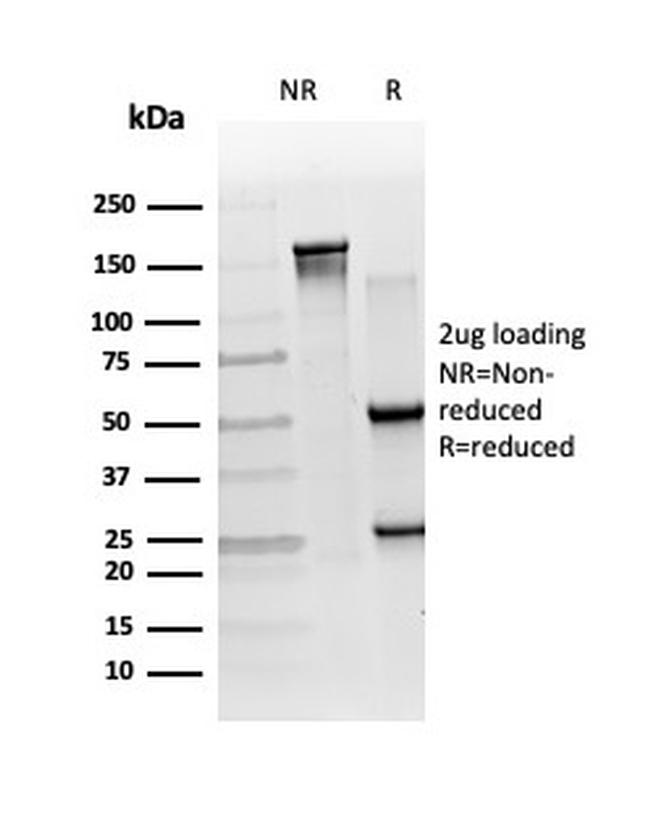 RXRB Antibody in SDS-PAGE (SDS-PAGE)