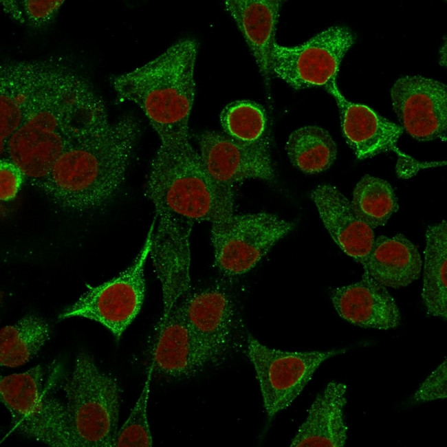 S100A2/S100 Calcium Binding Protein A2 Antibody in Immunocytochemistry (ICC/IF)