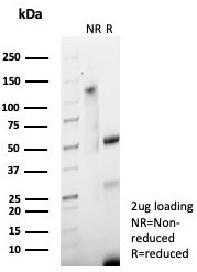 S100P/MIG9 Antibody in SDS-PAGE (SDS-PAGE)