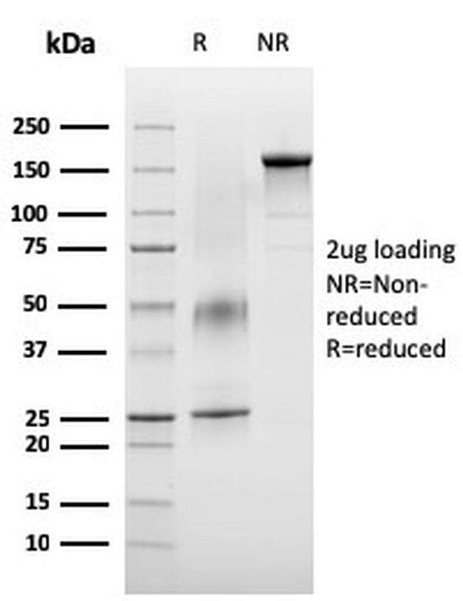 VISTA/B7-H5/VSIR (Negative Regulator of Immune Response) Antibody in SDS-PAGE (SDS-PAGE)