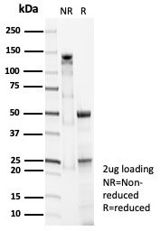 Pulmonary Surfactant-Associated Protein D (SFTPD) Antibody in SDS-PAGE (SDS-PAGE)
