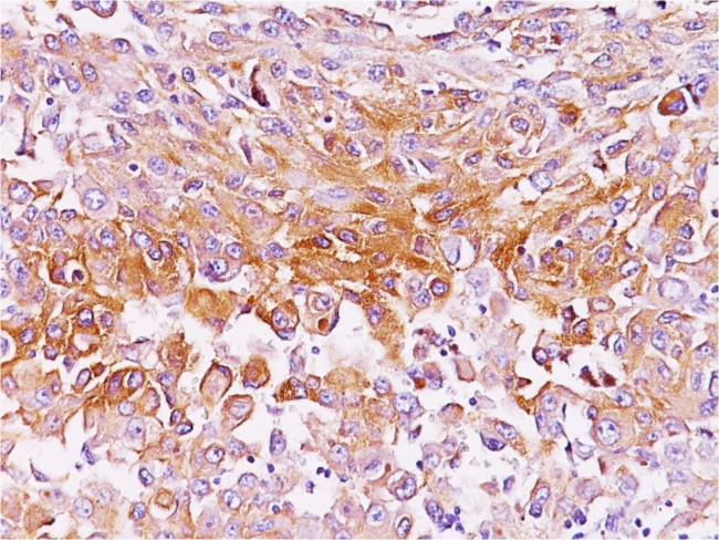 gp100/Melanosome/PMEL17/SILV (Melanoma Marker) Antibody in Immunohistochemistry (Paraffin) (IHC (P))