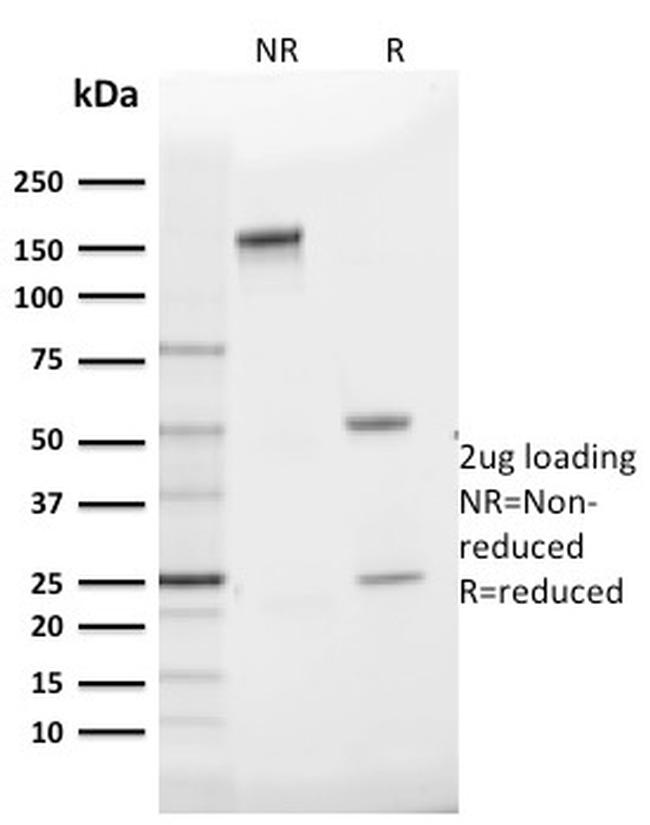 GLUT-1 Antibody in SDS-PAGE (SDS-PAGE)