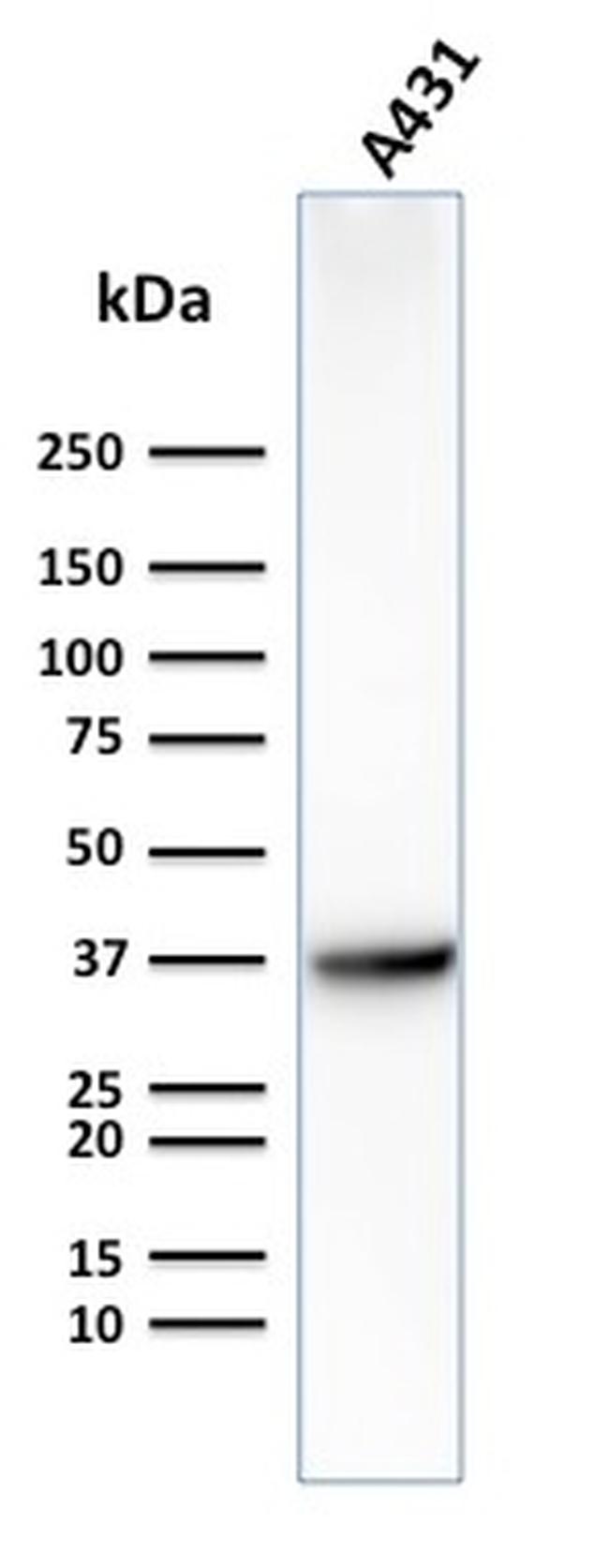 GLUT-1 Antibody in Western Blot (WB)