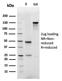 GLUT-1 (Tumor Progression and Mesothelioma Marker) Antibody in SDS-PAGE (SDS-PAGE)