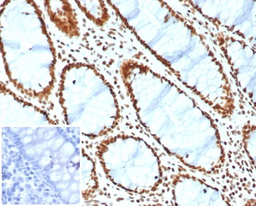 BRG1/SMARCA4 Antibody in Immunohistochemistry (Paraffin) (IHC (P))