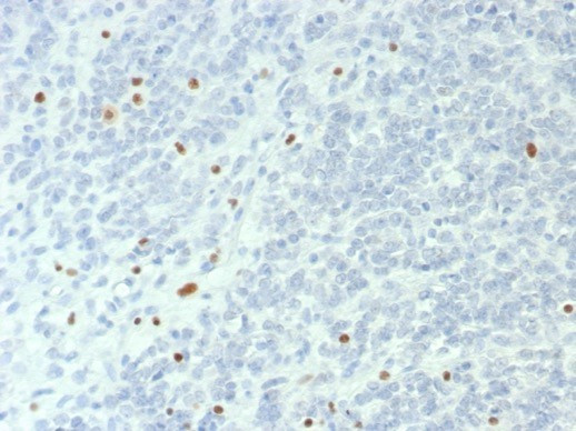 BRG1/SMARCA4 Antibody in Immunohistochemistry (Paraffin) (IHC (P))